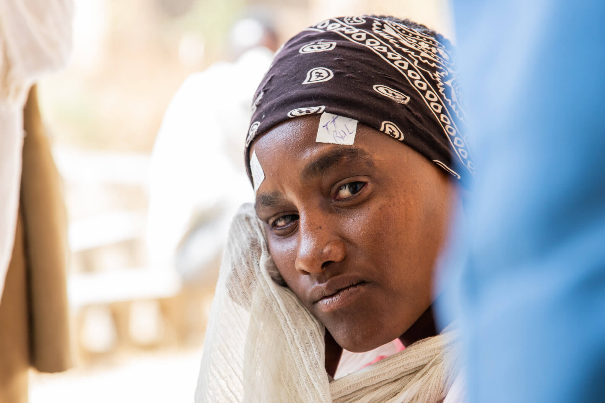 Tsege Naggasi, 23, along with other patients waits for trichiasis surgery at Quiha Hospital Secondary Eye Care Unit, Tigray region, Ethiopia.
