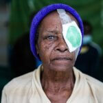 Maria Gimo Jorcida, an older woman wearing a purple knitted hat, looks at the camera with a green and white patch taped over one eye after surgery.